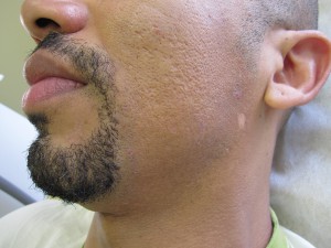Client 1B